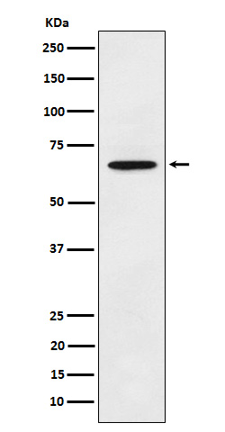 ECM1