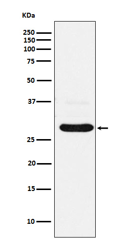 CHMP2B