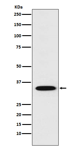 STX1A