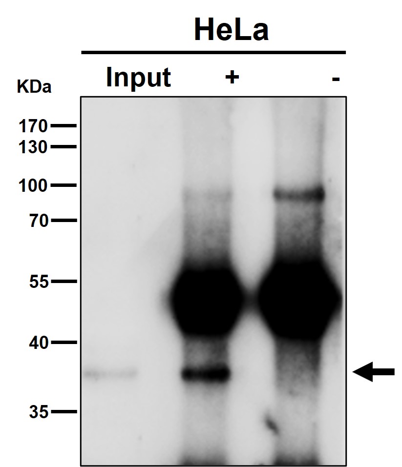 Rabbit Monoclonal to NFYA