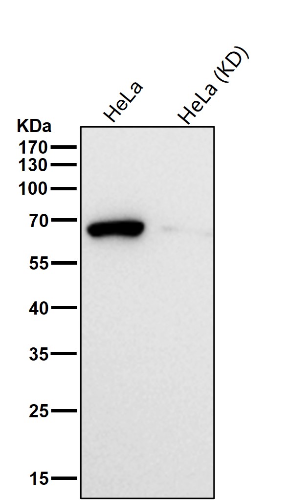 Rabbit Monoclonal to Lgi1