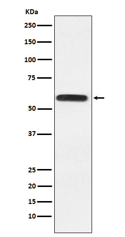 Lgi1