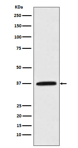 Kallikrein 5