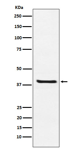 Arg2