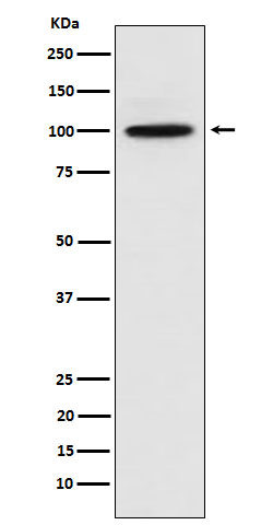 CTNNA3