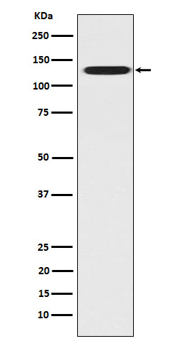 Rabbit Monoclonal to CC2D1A