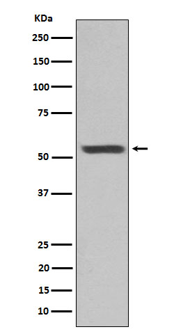 Cytokeratin 12