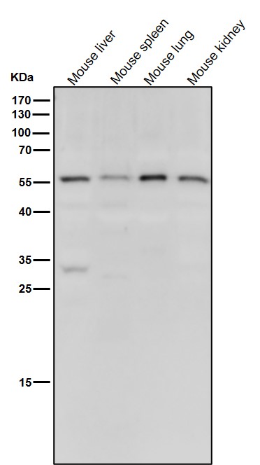 Rabbit Monoclonal to MLKL