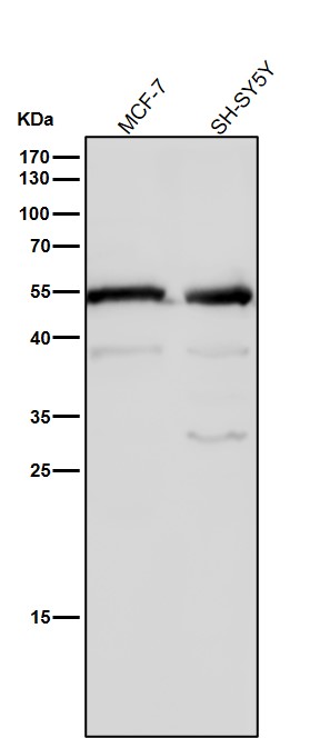 Rabbit Monoclonal to MLKL