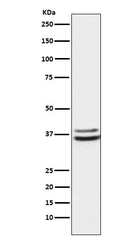 Rabbit Monoclonal to PIM2