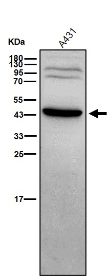Rabbit Monoclonal to Serpin B3