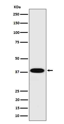Cathepsin H