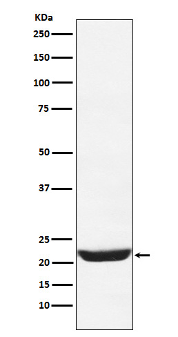 NCS1