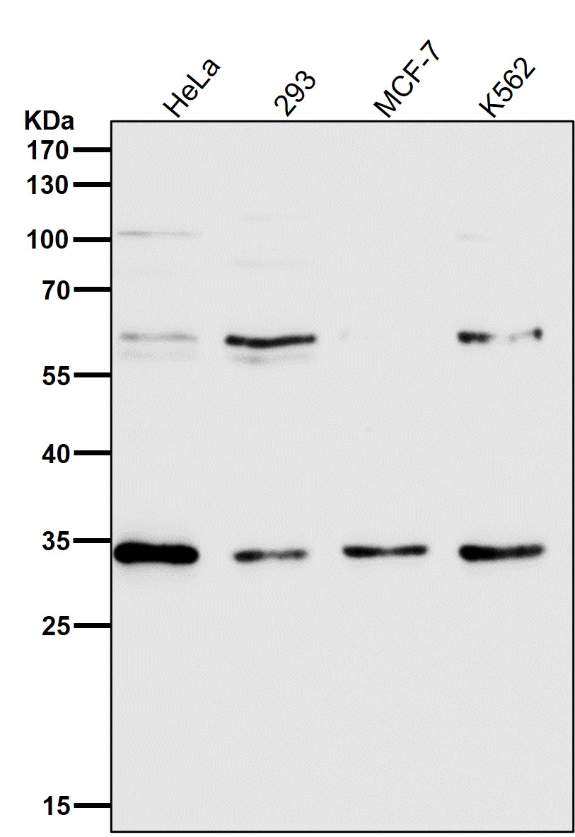 NUDT5