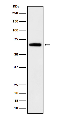 IGF2BP2