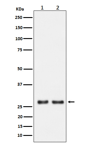 Rabbit Monoclonal to UPP1