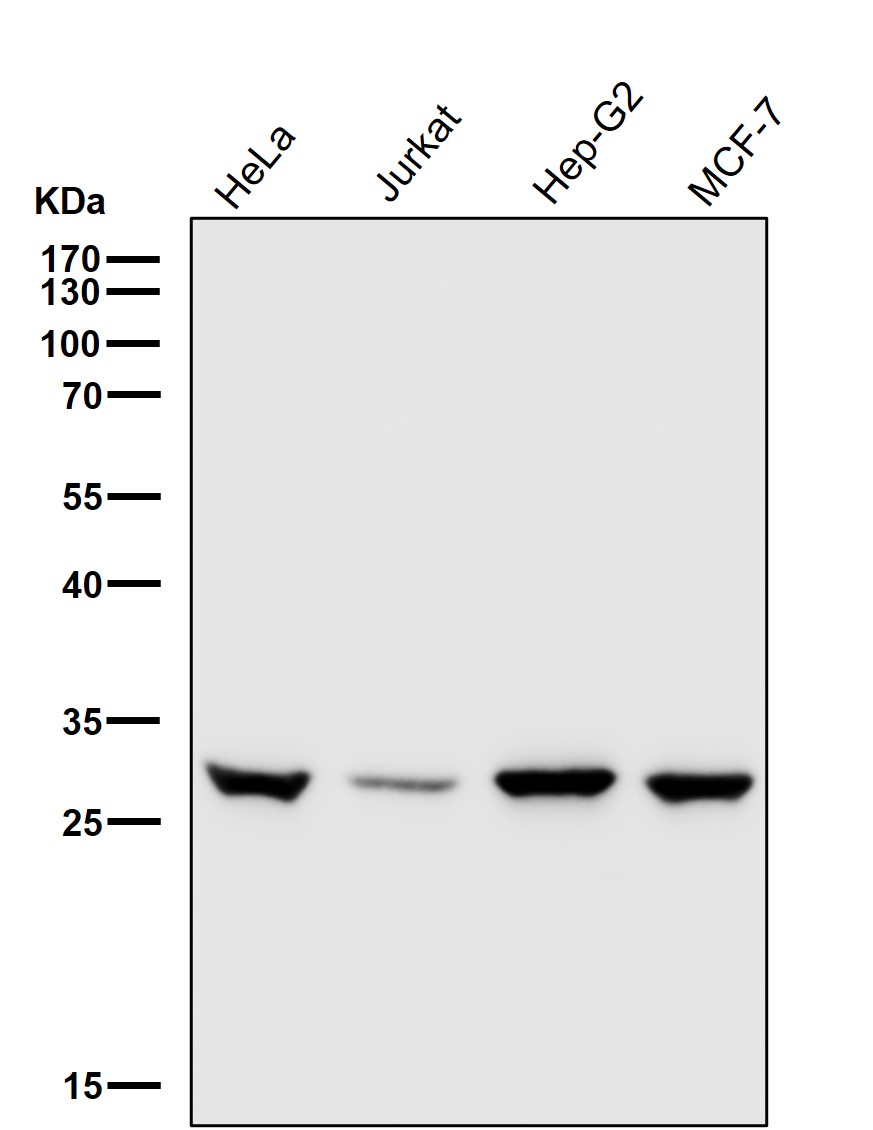 Rabbit Monoclonal to UPP1