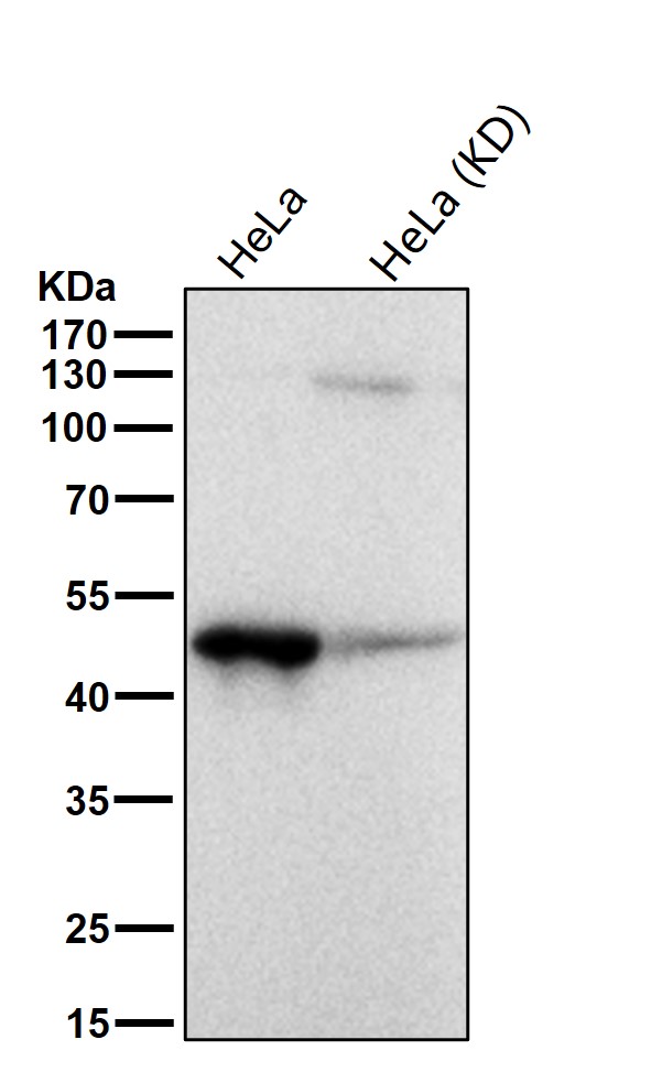 Rabbit Monoclonal to ACAA2