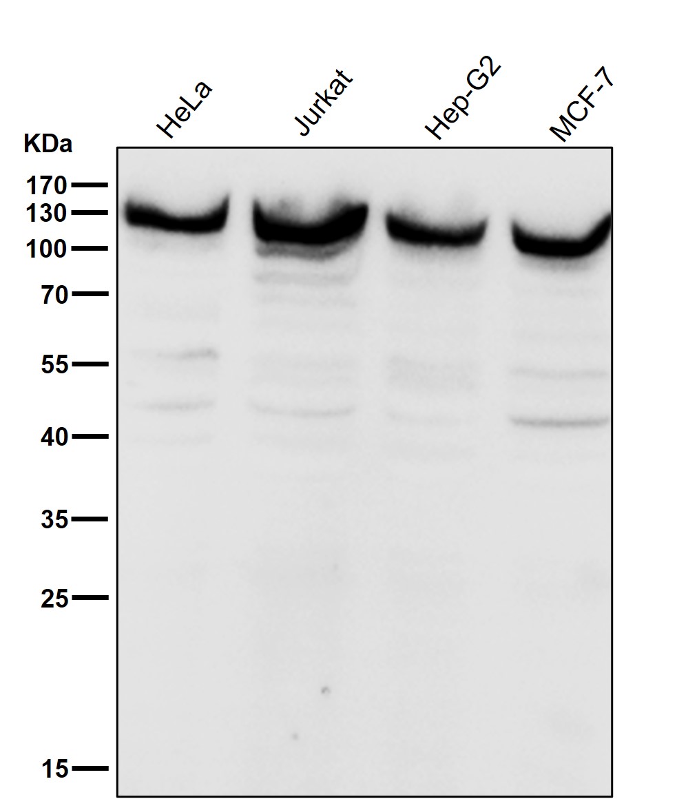 Rabbit Monoclonal to UBE4A