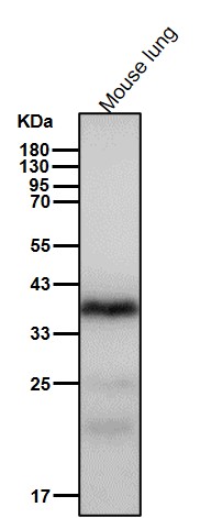 Rabbit Monoclonal to HDGF