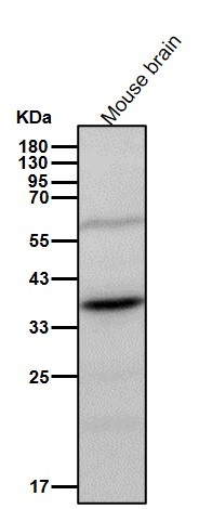 Rabbit Monoclonal to HDGF