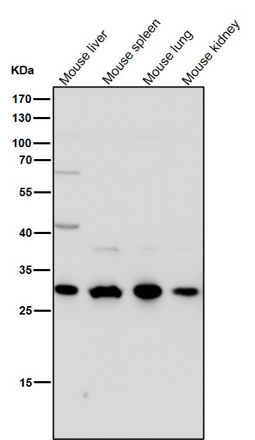 CTR1/SLC31A1