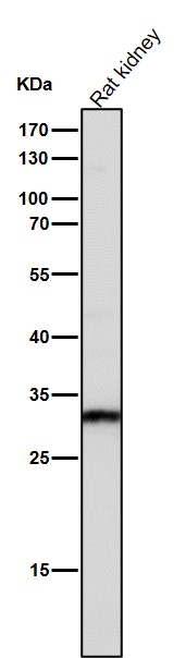 Rabbit Monoclonal to CTR1/SLC31A1