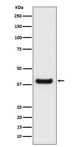 Rabbit Monoclonal to Erlin-2