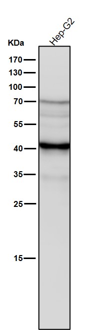 Rabbit Monoclonal to Erlin-2