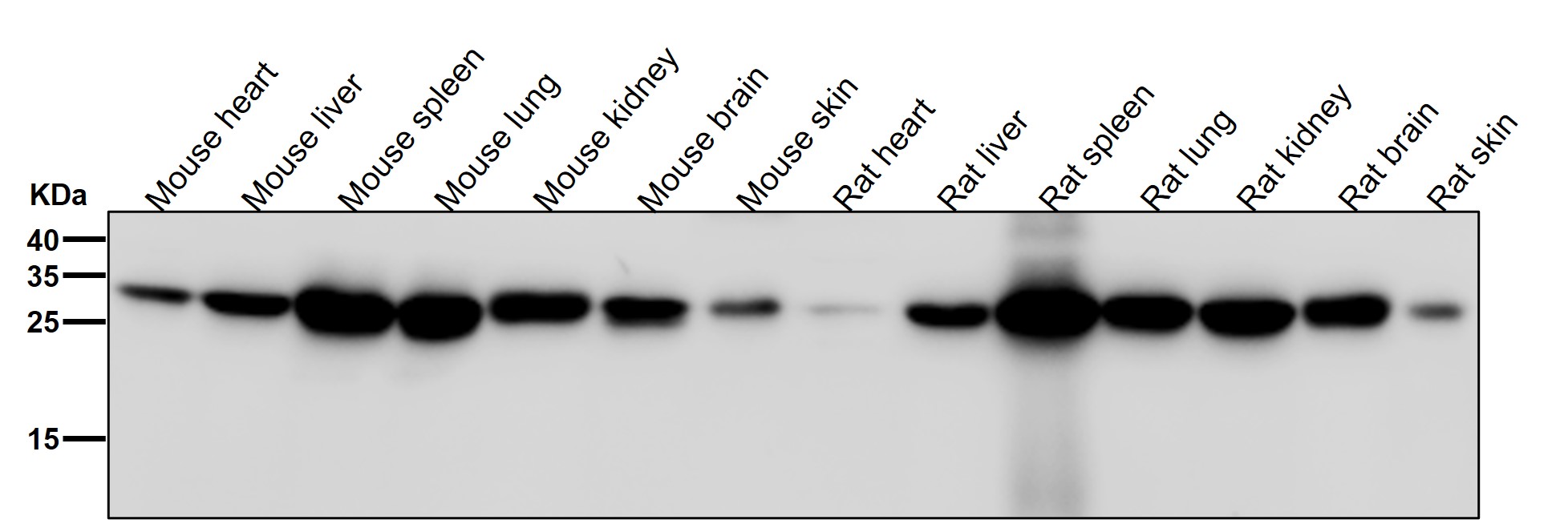 Rabbit Monoclonal to PHD3