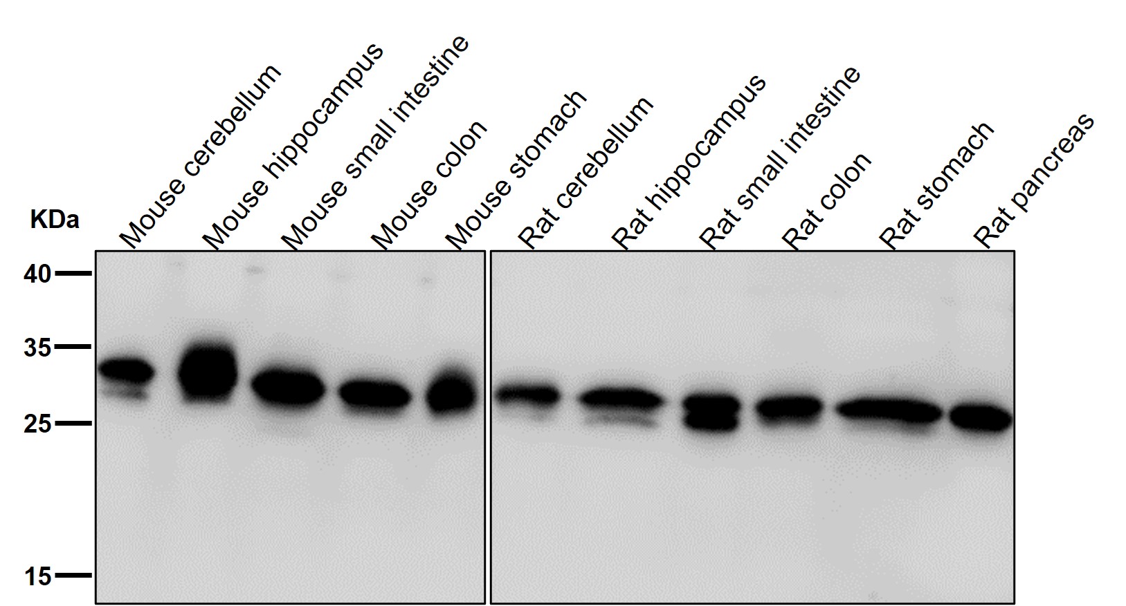 Rabbit Monoclonal to PHD3
