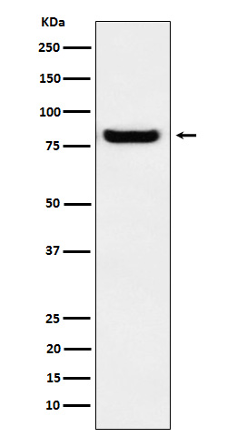 GLU2B