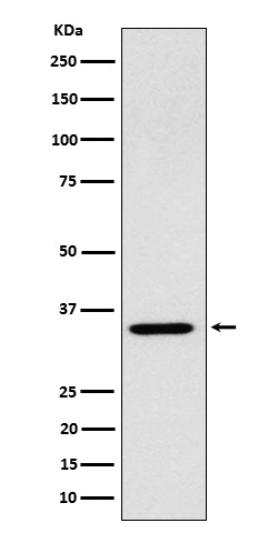 ARPC2
