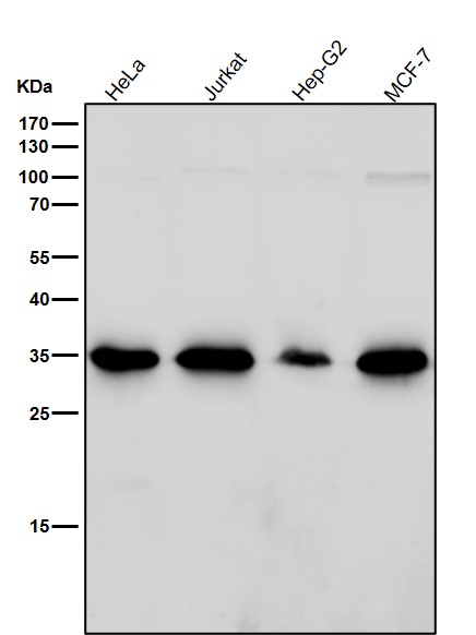 Rabbit Monoclonal to ARPC2