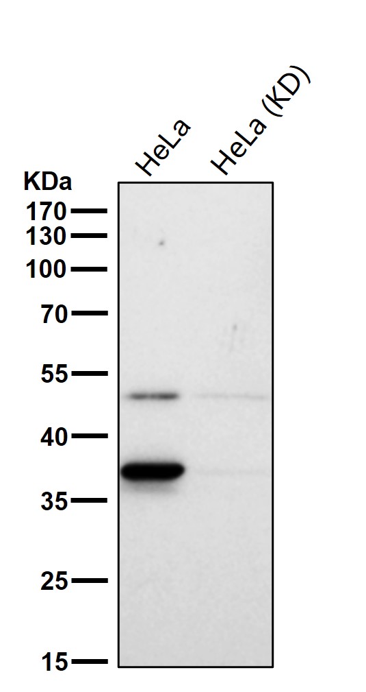 Rabbit Monoclonal to ACAT2