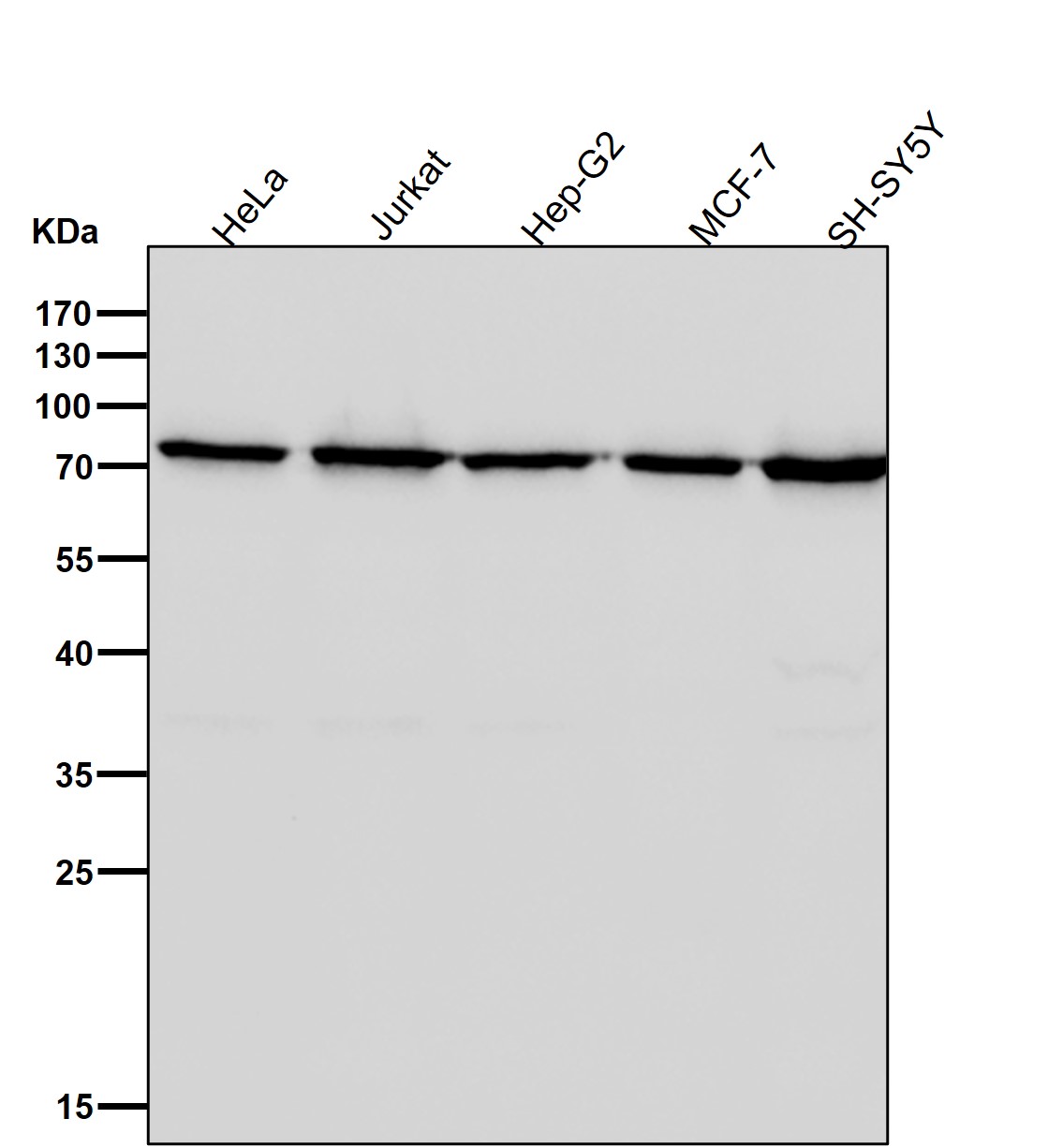 Rabbit Monoclonal to CPSF73