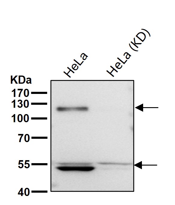 Rabbit Monoclonal to ORP1