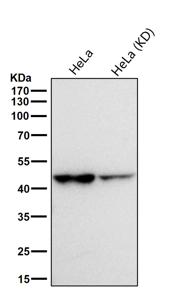 Rabbit Monoclonal to ELP4