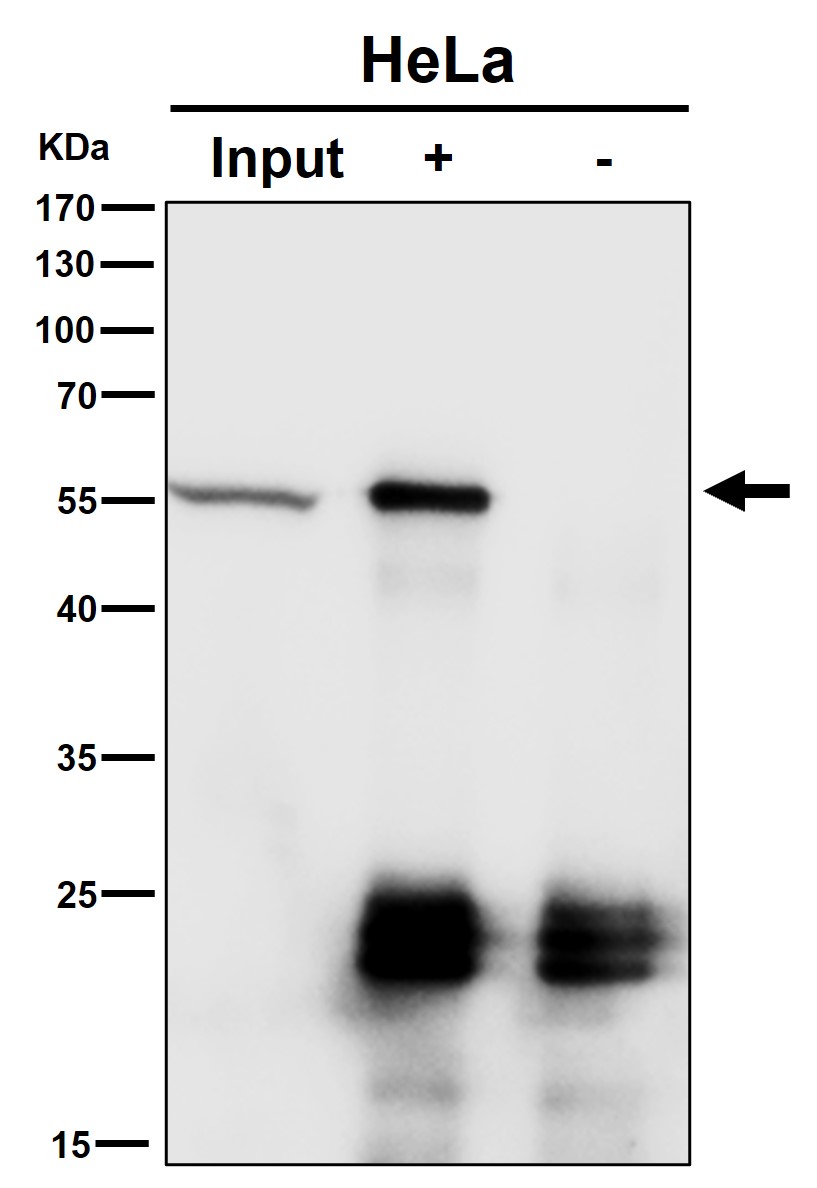 Rabbit Monoclonal to CAP1