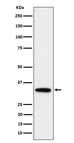 PPP6C