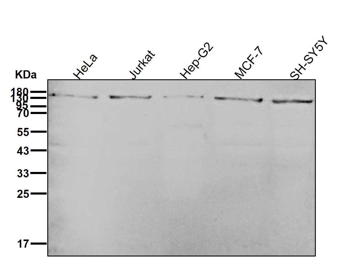 Rabbit Monoclonal to AGL
