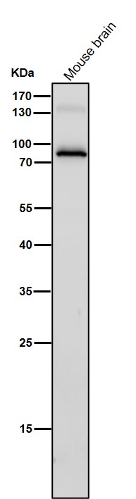 Rabbit Monoclonal to IL12B