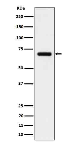 CD125