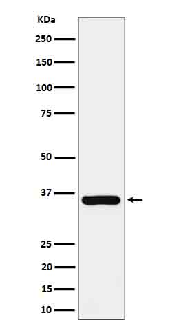 Rabbit Monoclonal to Gamma glutamyl hydrolase
