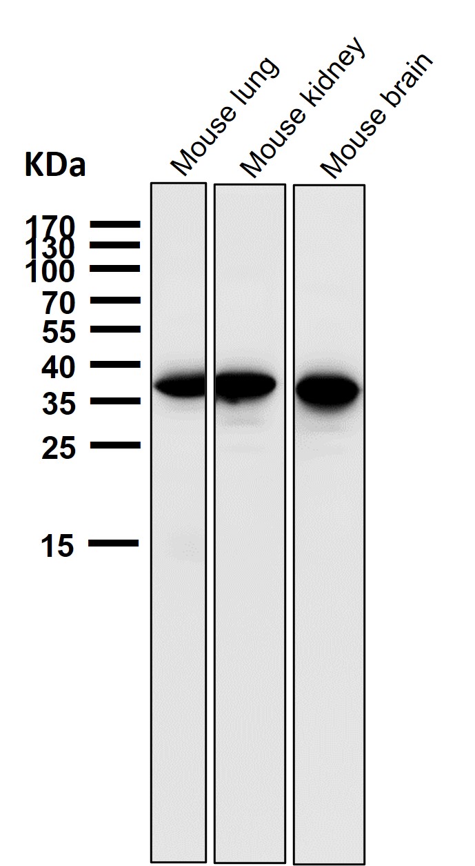 Gamma glutamyl hydrolase