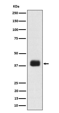 SR protein repeat