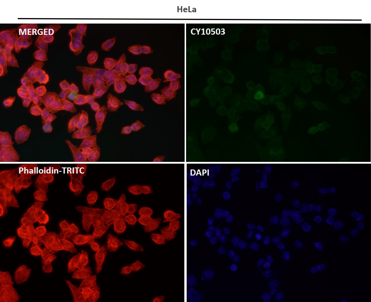 Rabbit Monoclonal to Spermine synthase