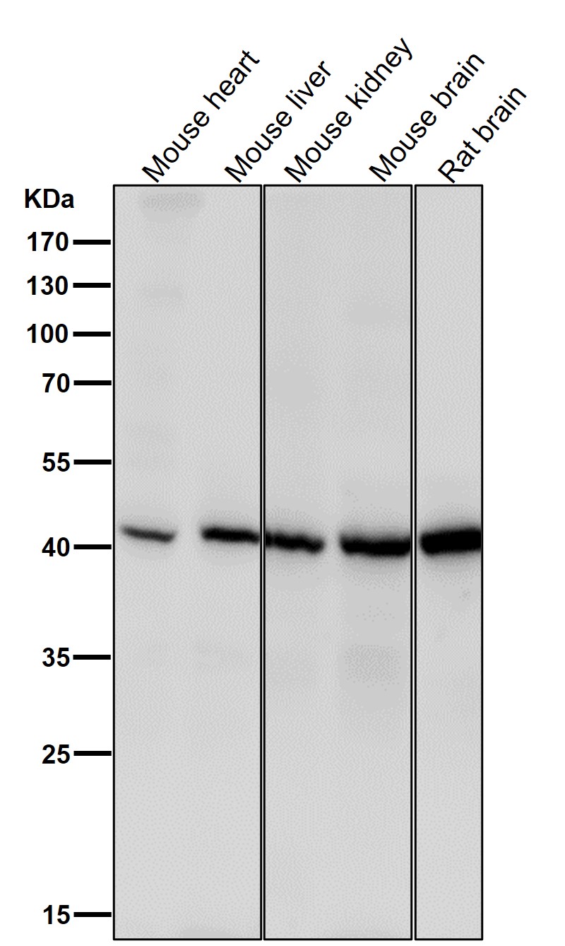Spermine synthase