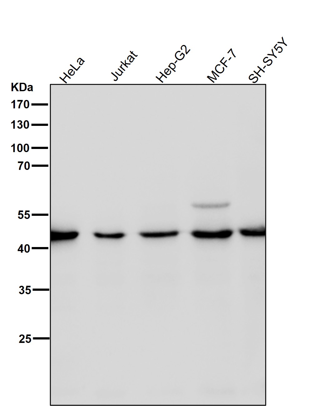 Rabbit Monoclonal to Spermine synthase