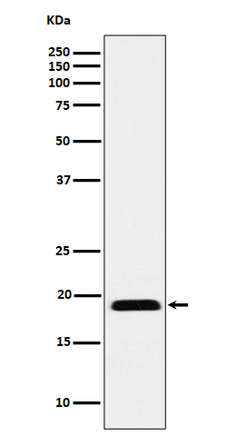 MYL12B